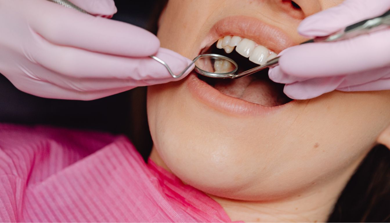 Імплантація за методикою All-on-6